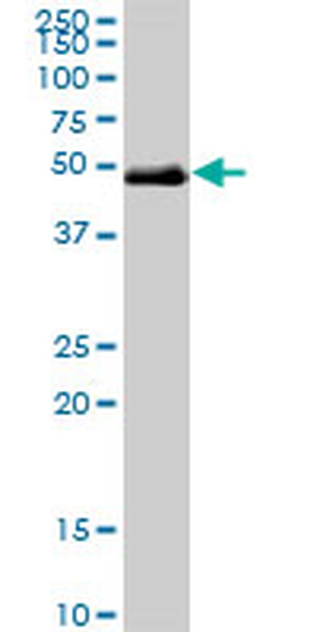 TCF2 Antibody in Western Blot (WB)