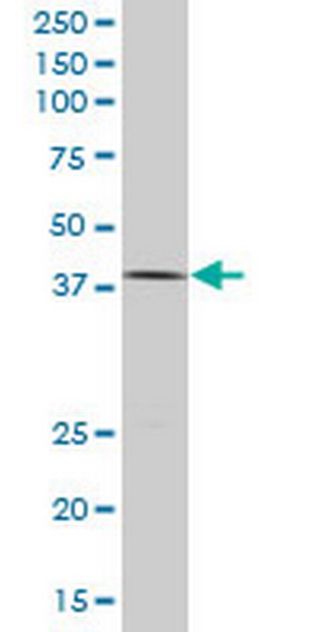 TCF2 Antibody in Western Blot (WB)