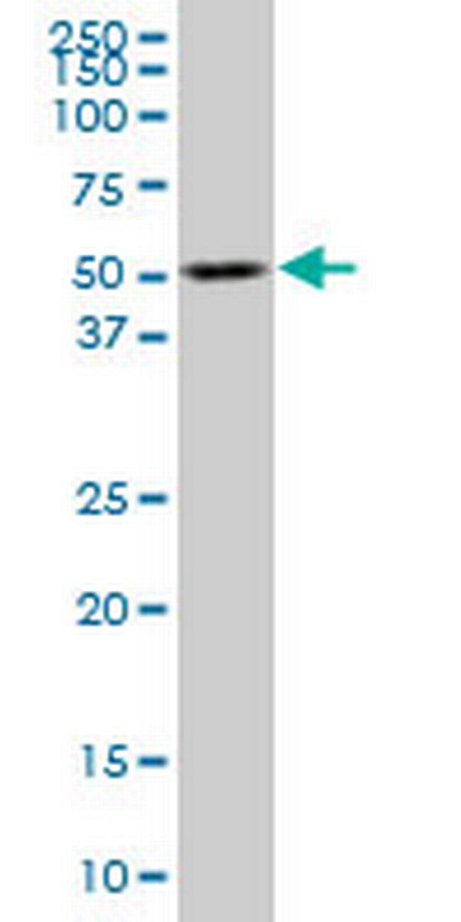 TCF2 Antibody in Western Blot (WB)