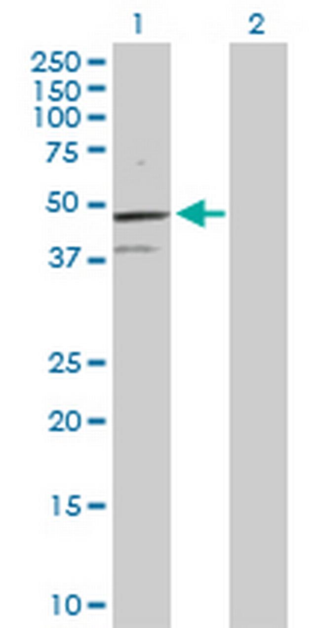 TCF7 Antibody in Western Blot (WB)