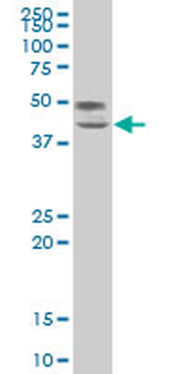 TCF7 Antibody in Western Blot (WB)