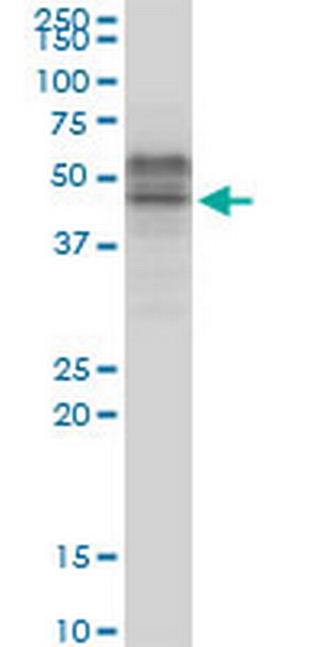 TCF7 Antibody in Western Blot (WB)