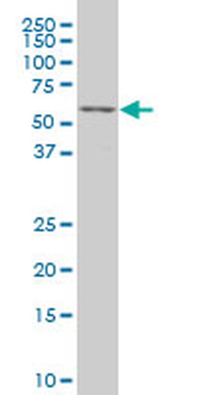 TCF7L2 Antibody in Western Blot (WB)