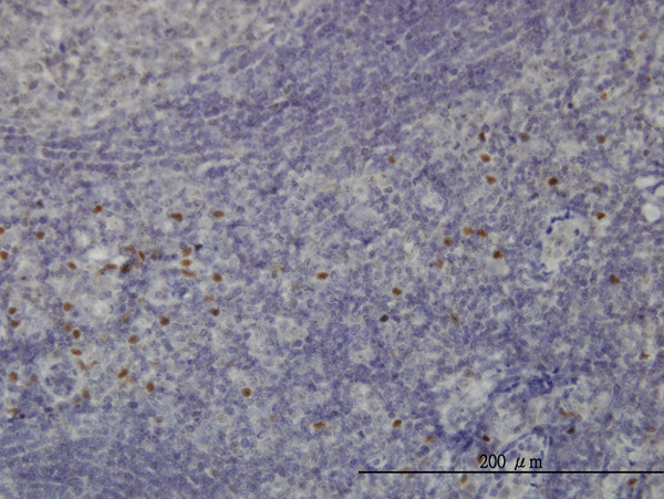 TCF12 Antibody in Immunohistochemistry (Paraffin) (IHC (P))