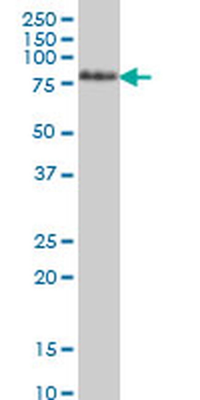 TCF12 Antibody in Western Blot (WB)