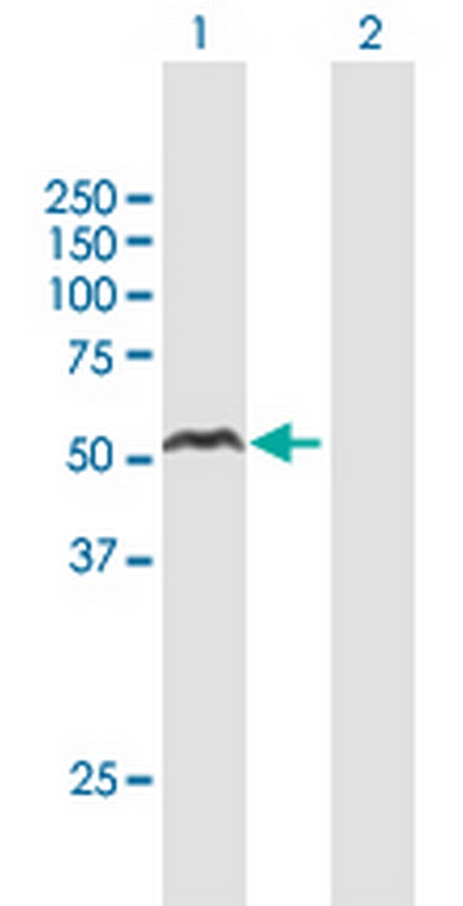 VPS72 Antibody in Western Blot (WB)