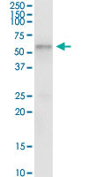 TCN1 Antibody in Immunoprecipitation (IP)