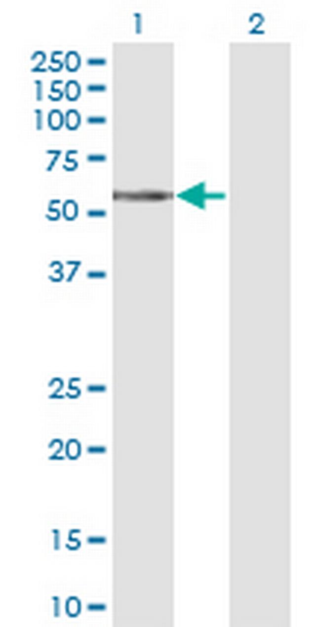 TCN1 Antibody in Western Blot (WB)