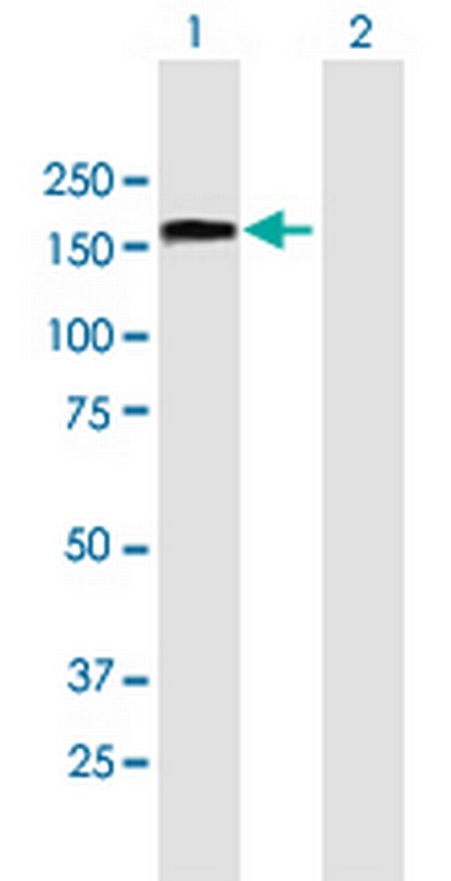 TCOF1 Antibody in Western Blot (WB)