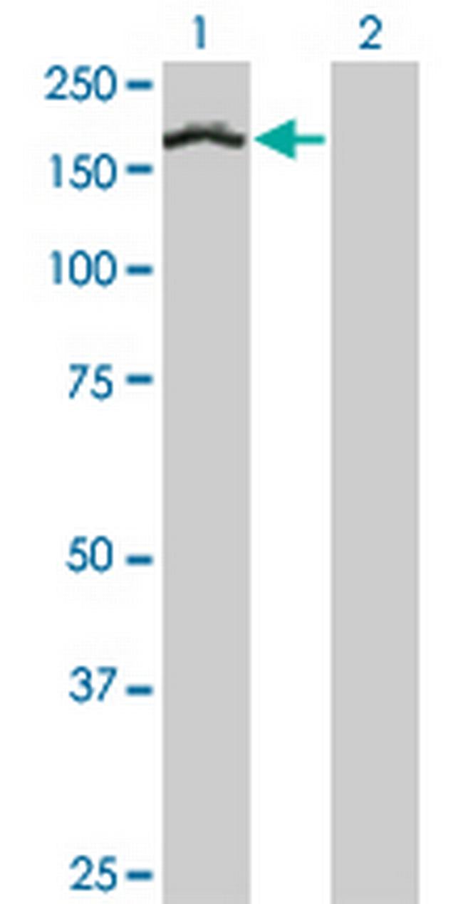 TCOF1 Antibody in Western Blot (WB)