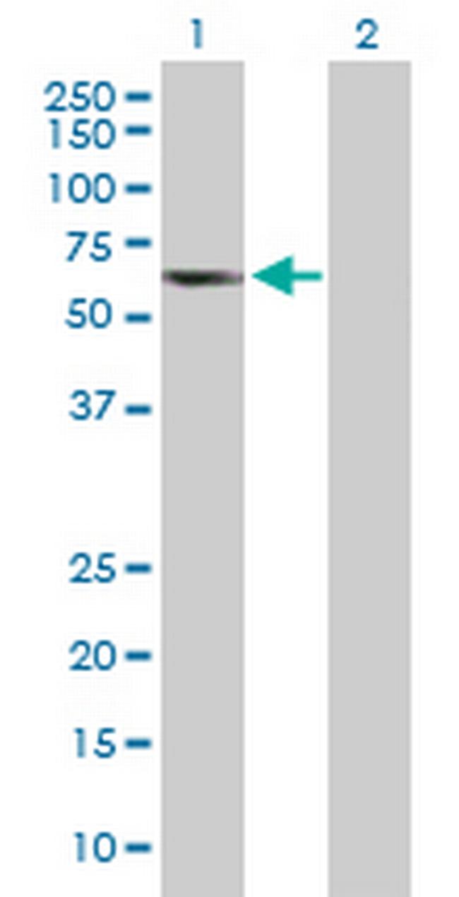 TCP11 Antibody in Western Blot (WB)