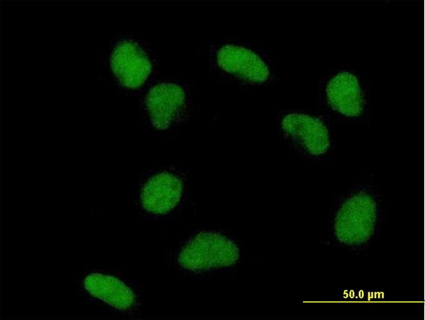 TDG Antibody in Immunocytochemistry (ICC/IF)