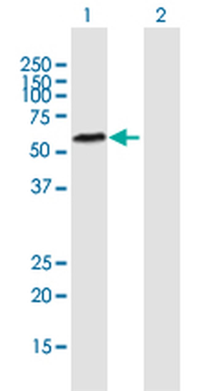 TDG Antibody in Western Blot (WB)