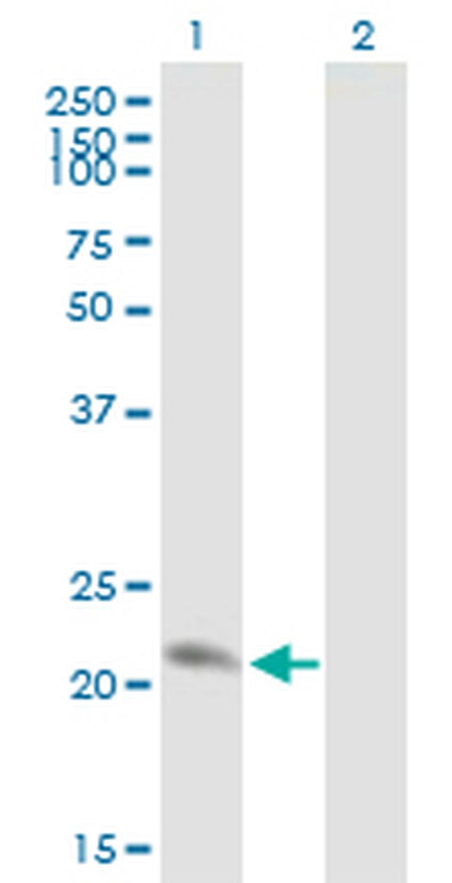 PRDX2 Antibody in Western Blot (WB)