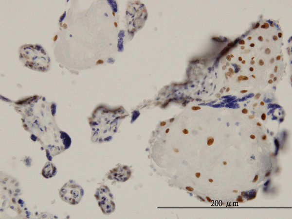 TEAD4 Antibody in Immunohistochemistry (Paraffin) (IHC (P))