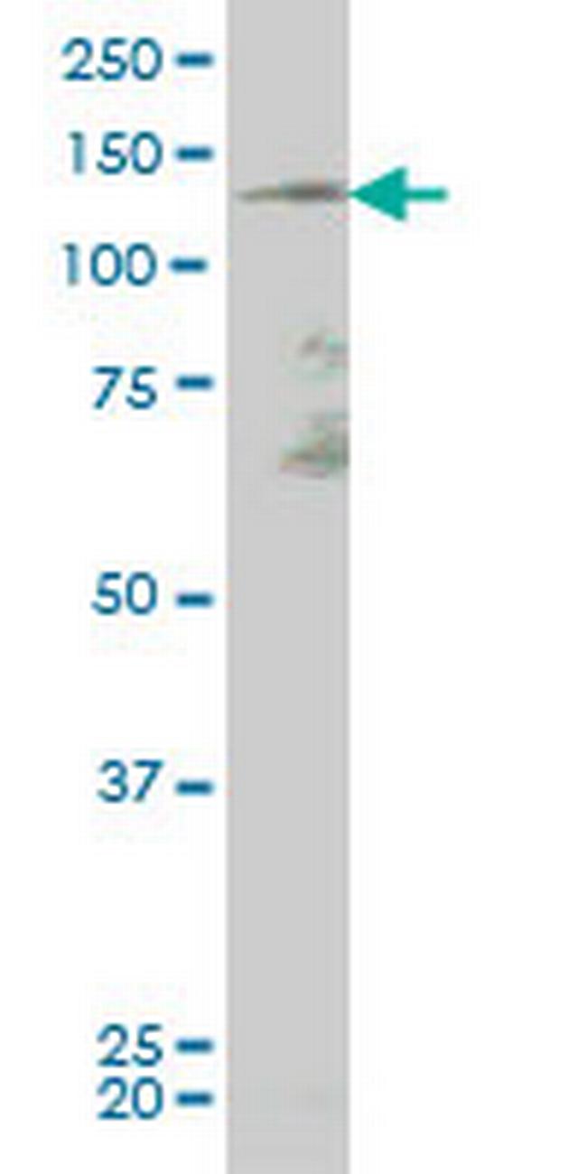 TEK Antibody in Western Blot (WB)