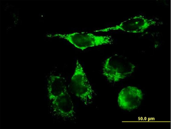 TFAM Antibody in Immunocytochemistry (ICC/IF)