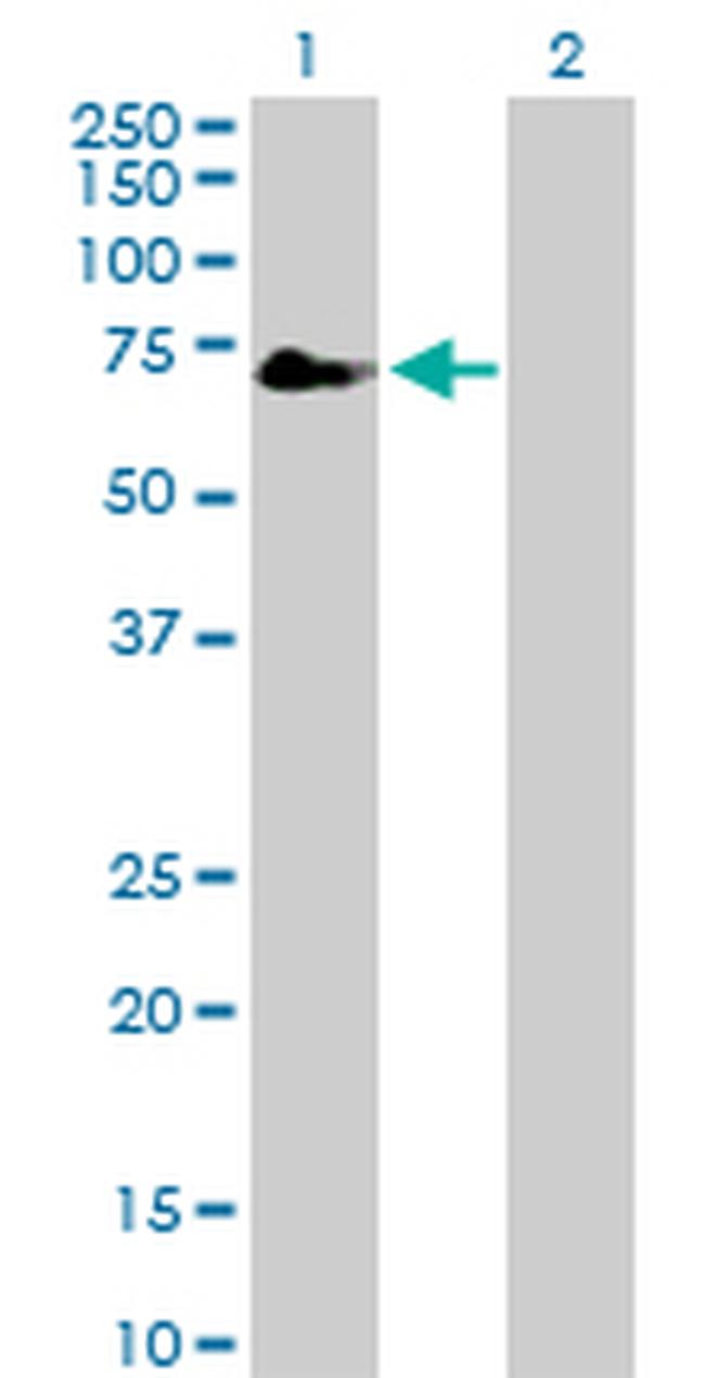 TFCP2 Antibody in Western Blot (WB)