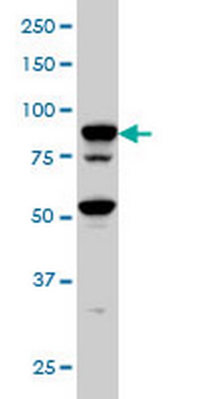 TFRC Antibody in Western Blot (WB)