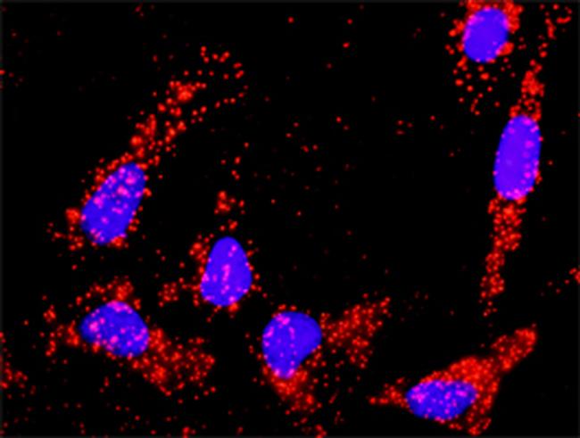 TGFB2 Antibody in Proximity Ligation Assay (PLA) (PLA)