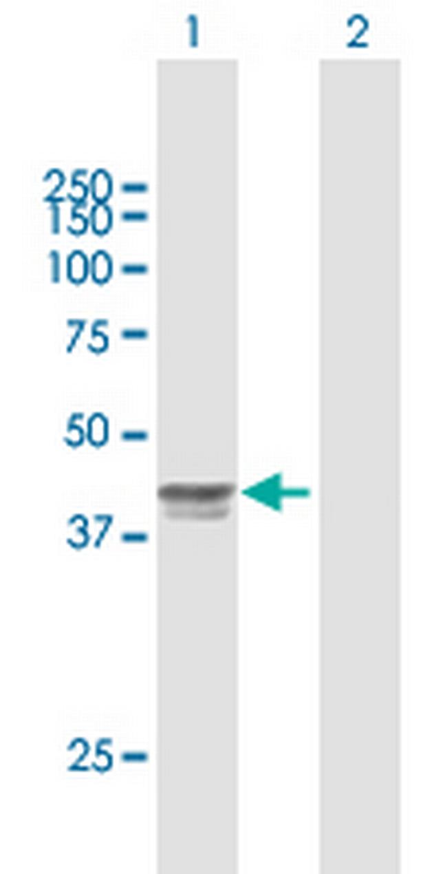 LEFTY2 Antibody in Western Blot (WB)