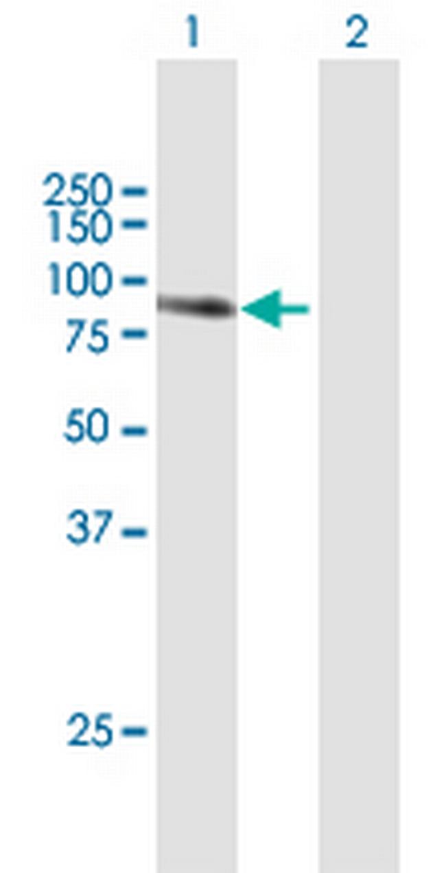 TGM1 Antibody in Western Blot (WB)