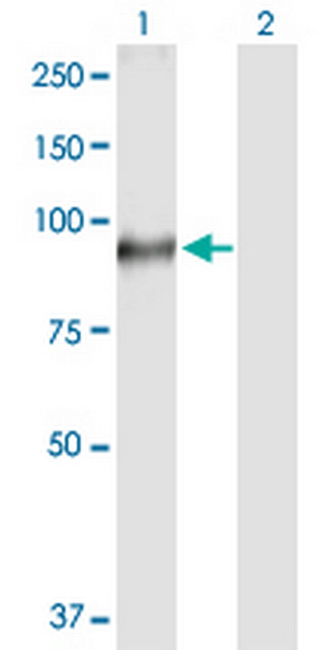 TGM1 Antibody in Western Blot (WB)