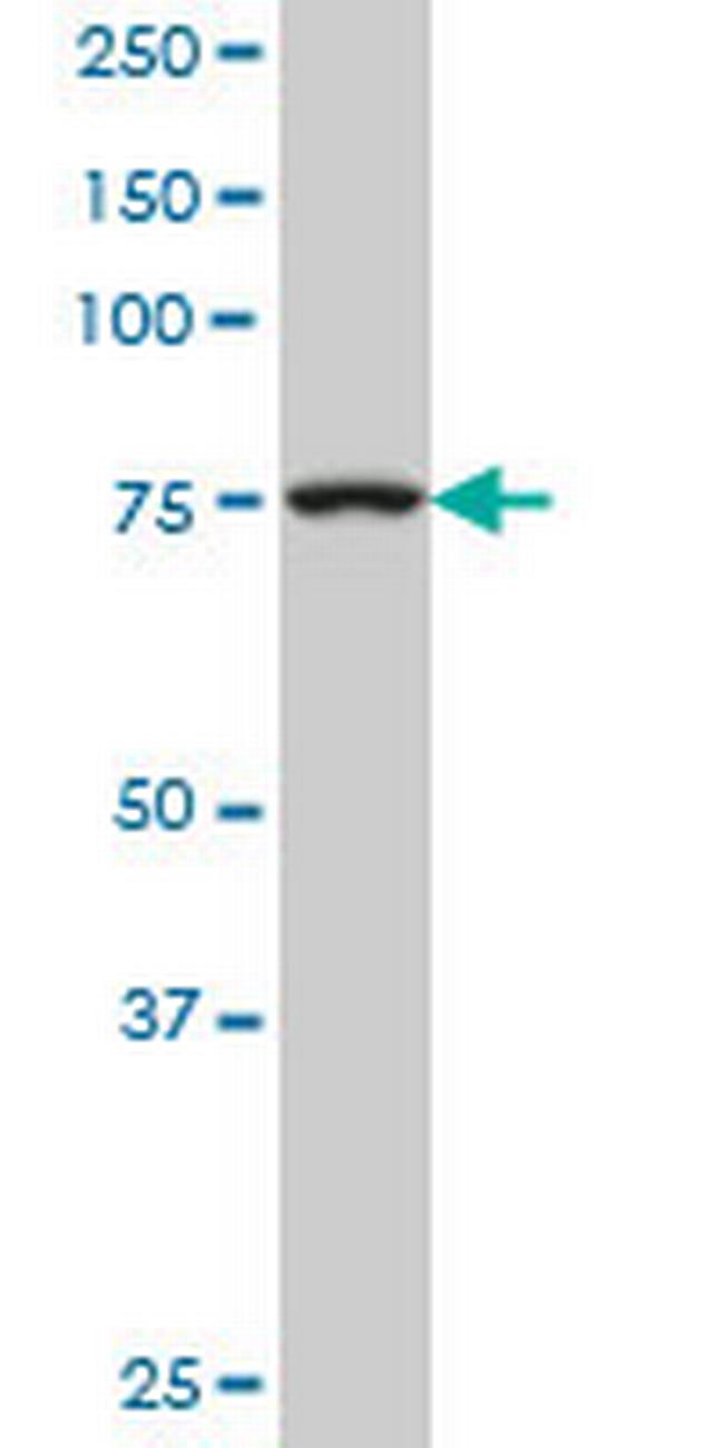 TGM2 Antibody in Western Blot (WB)