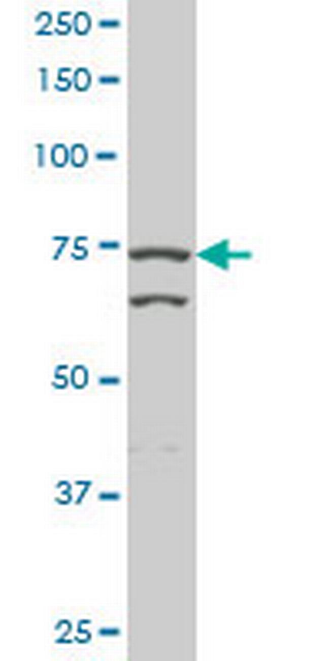 TGM2 Antibody in Western Blot (WB)