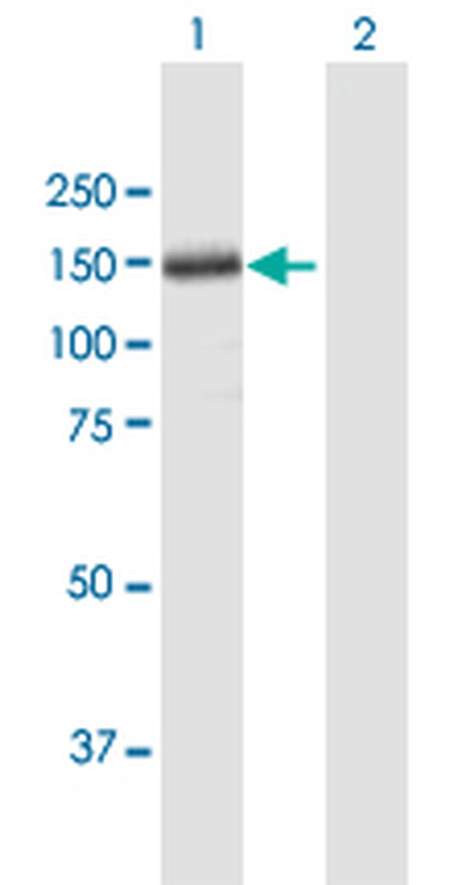 THBS4 Antibody in Western Blot (WB)