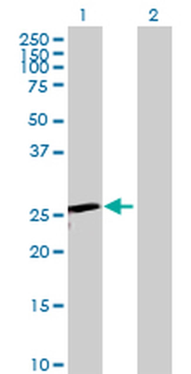 TK1 Antibody in Western Blot (WB)