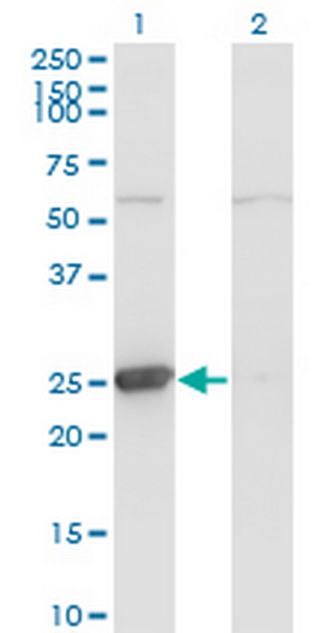 TK1 Antibody in Western Blot (WB)