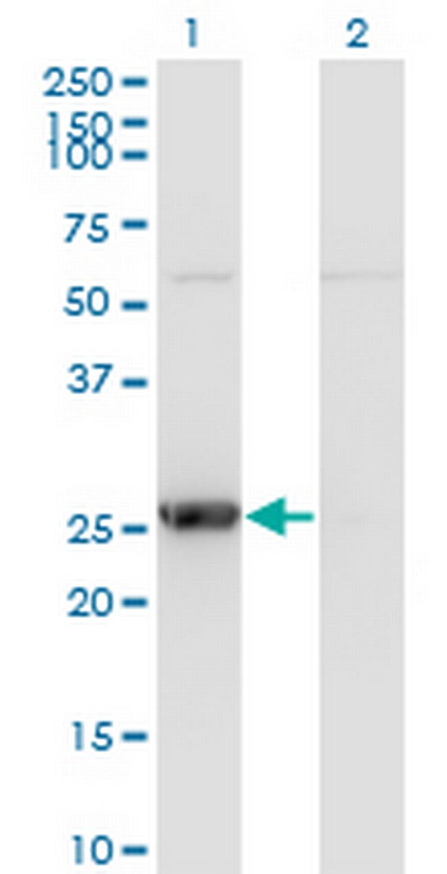 TK1 Antibody in Western Blot (WB)