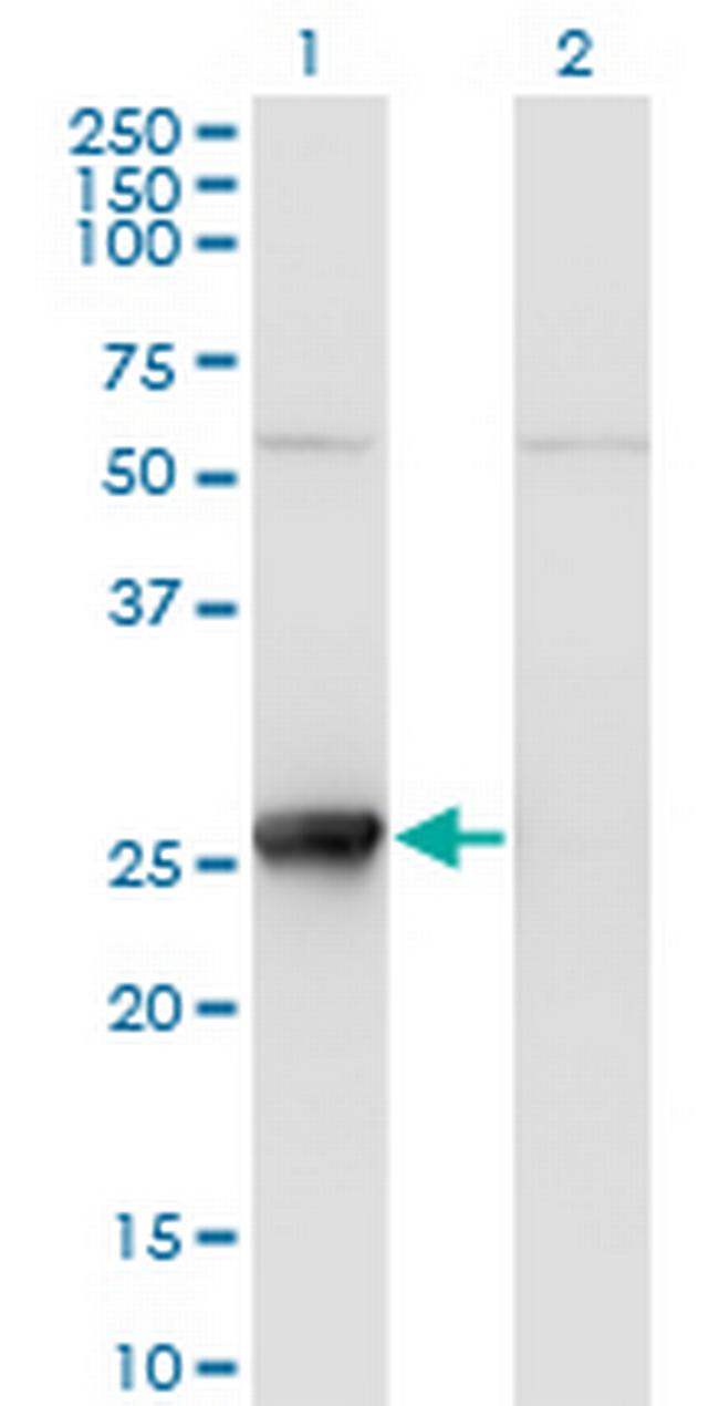 TK1 Antibody in Western Blot (WB)