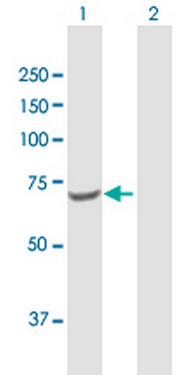 TKT Antibody in Western Blot (WB)