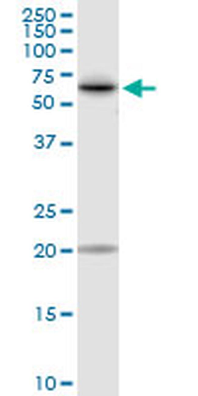 TKT Antibody in Western Blot (WB)