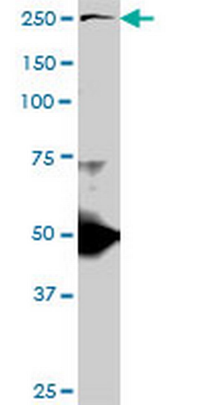 TLN1 Antibody in Western Blot (WB)