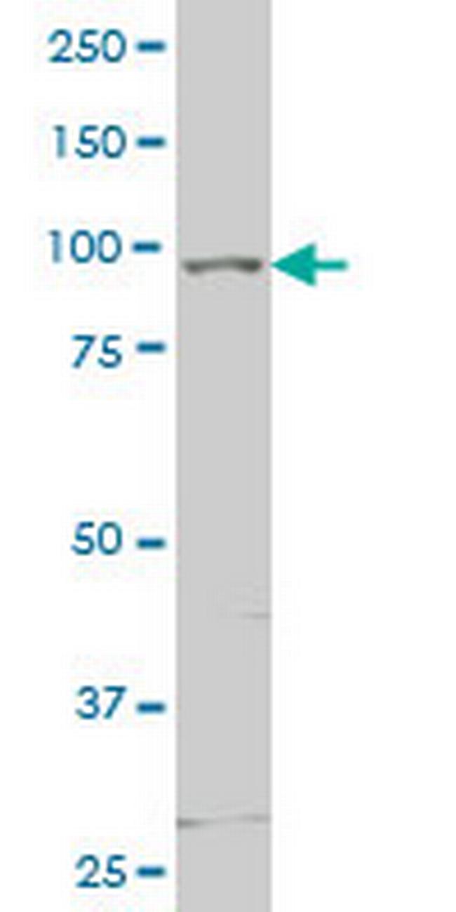 TLR5 Antibody in Western Blot (WB)