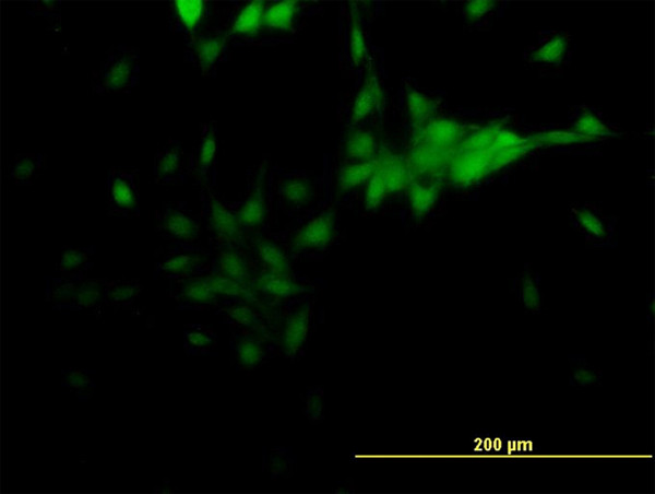 NR2E1 Antibody in Immunocytochemistry (ICC/IF)