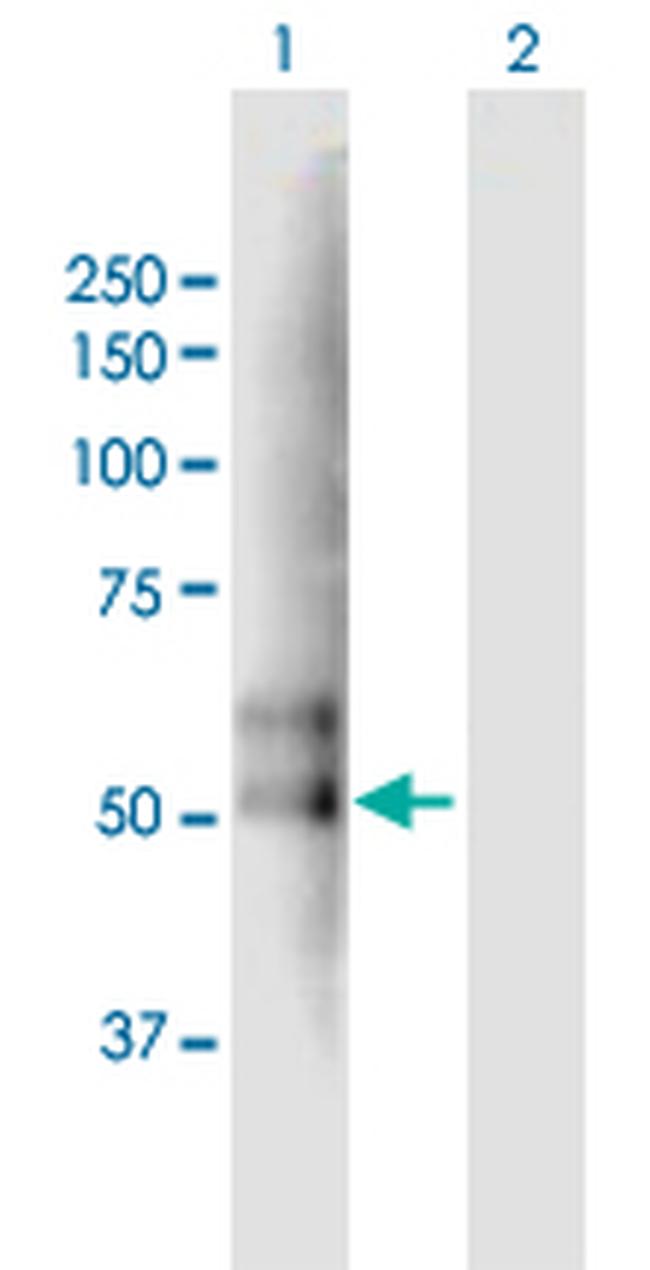 TMPRSS2 Antibody in Western Blot (WB)