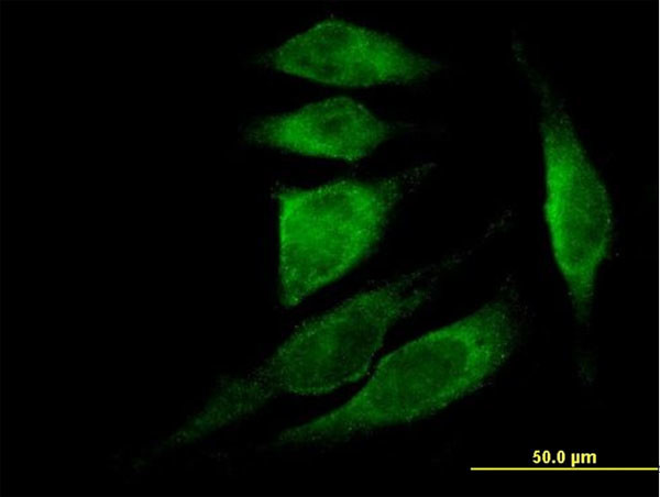 TMSB4X Antibody in Immunocytochemistry (ICC/IF)