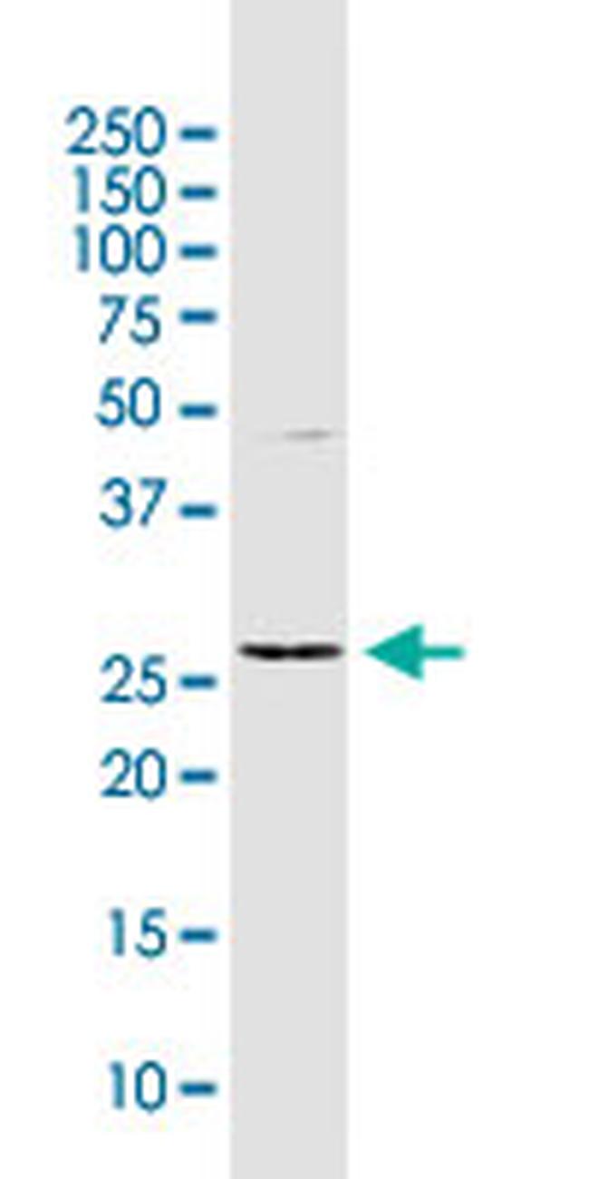 TNFAIP6 Antibody in Western Blot (WB)