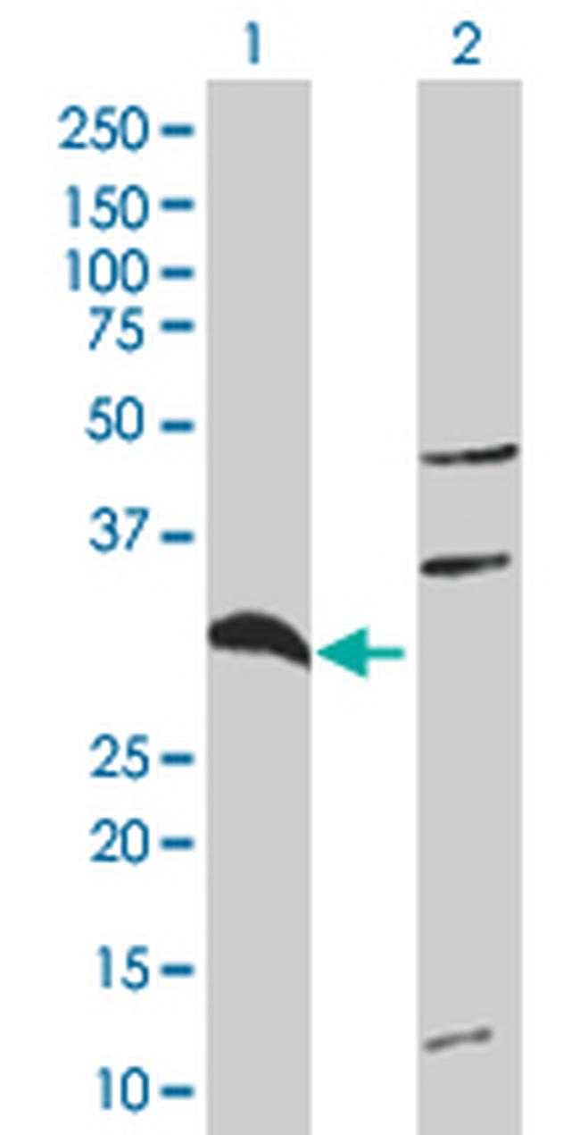 TNFAIP6 Antibody in Western Blot (WB)