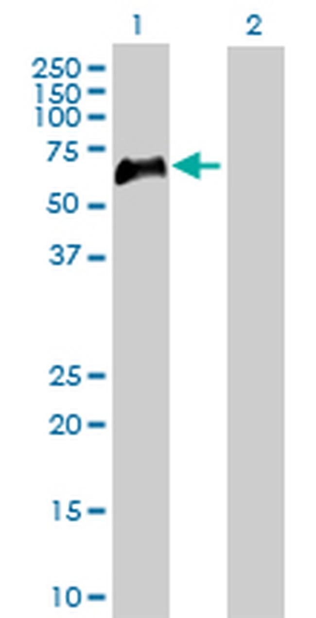 TNFRSF1B Antibody in Western Blot (WB)