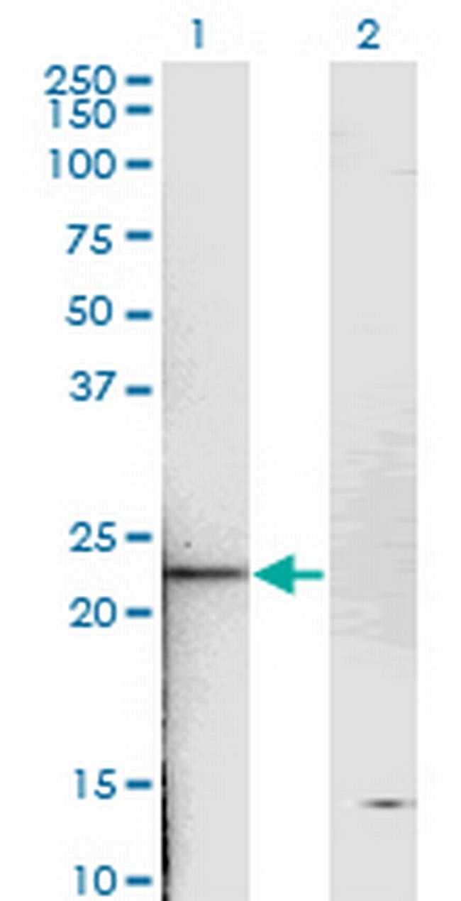 TNNI2 Antibody in Western Blot (WB)