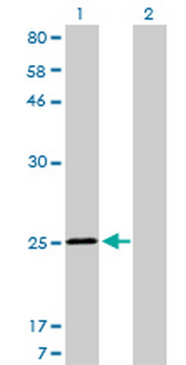 TNNI3 Antibody in Western Blot (WB)