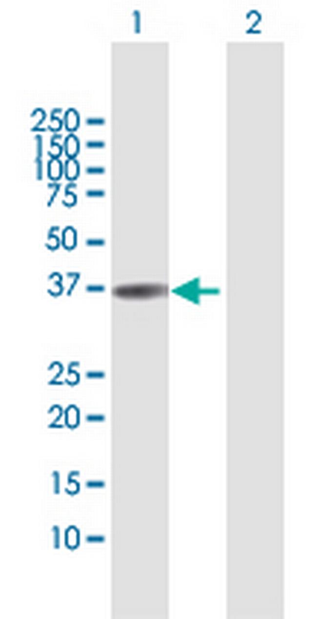 TNNT1 Antibody in Western Blot (WB)