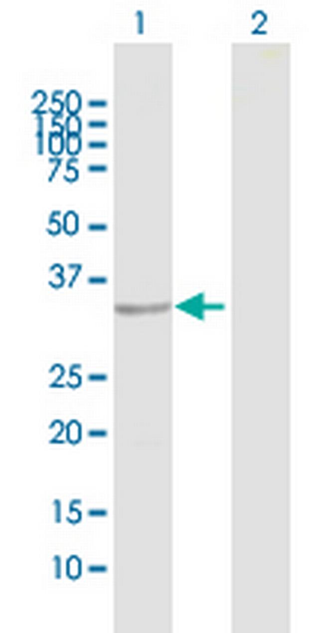 TNNT1 Antibody in Western Blot (WB)