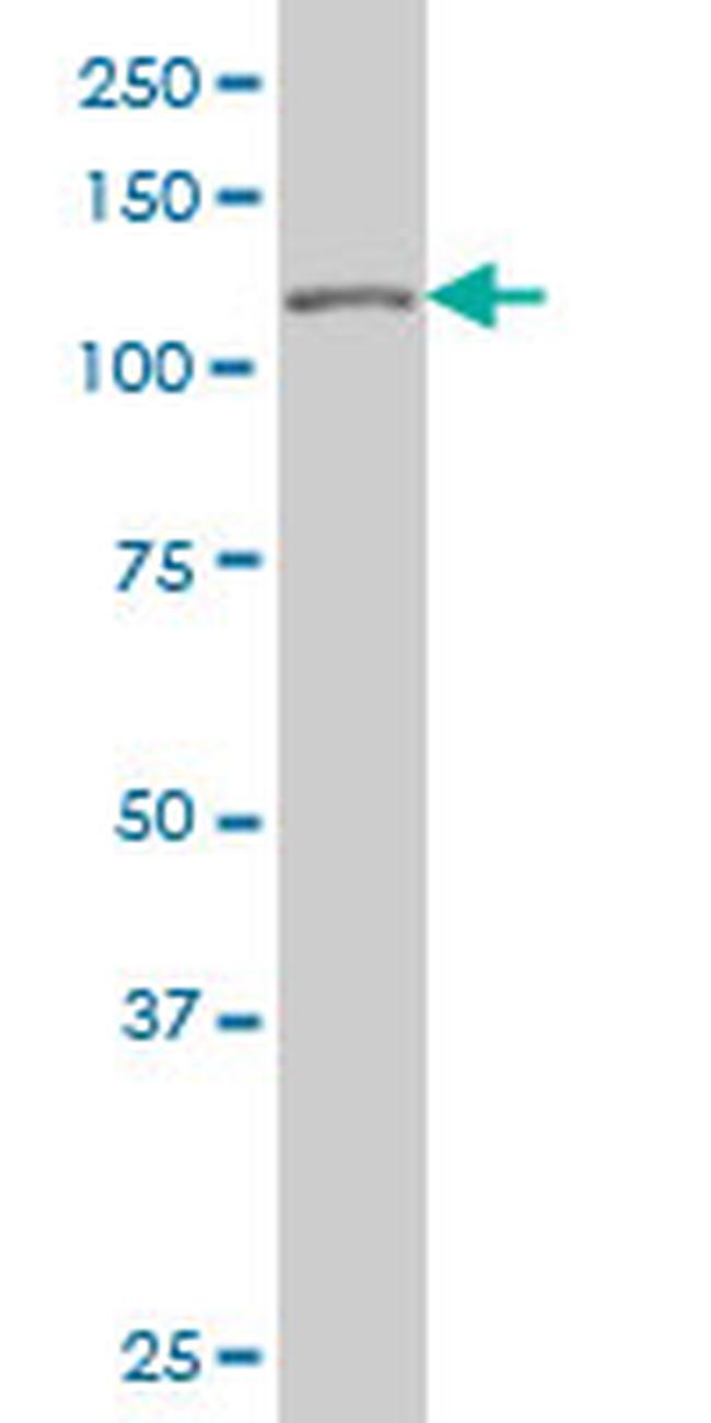 TP53BP2 Antibody in Western Blot (WB)