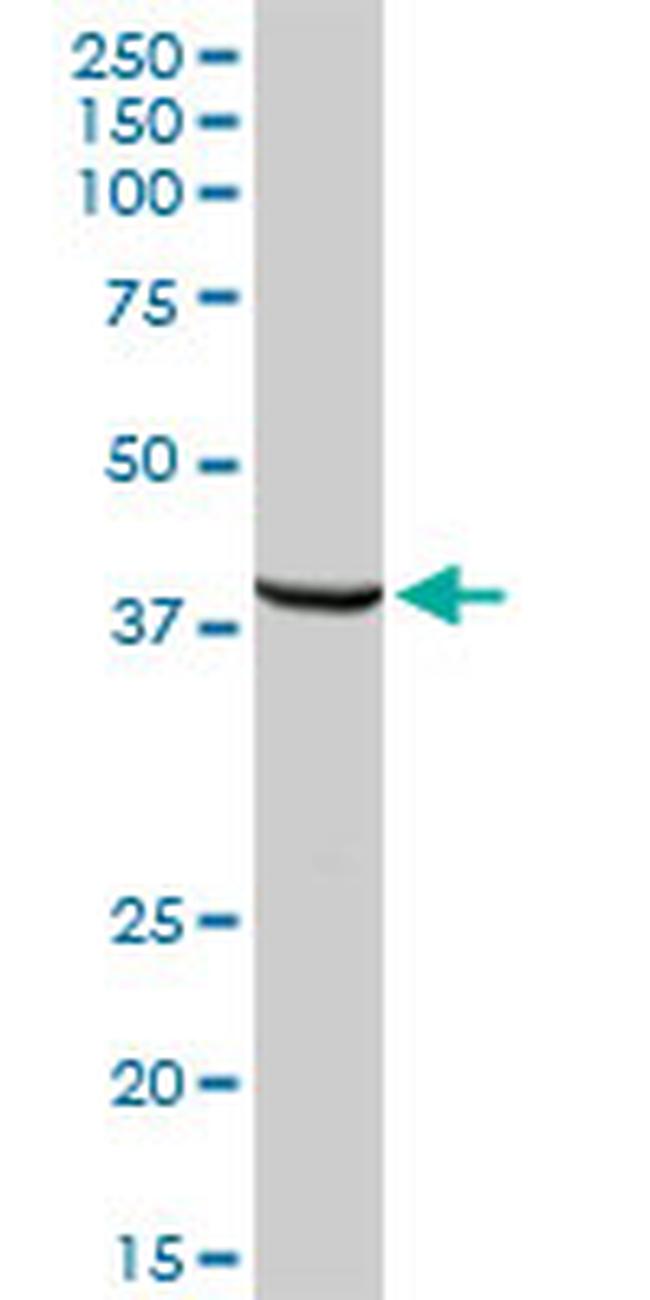 TPBG Antibody in Western Blot (WB)